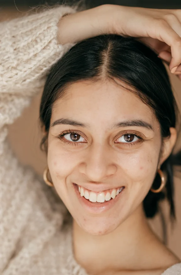Indian woman smiling- Acne Scar Reduction