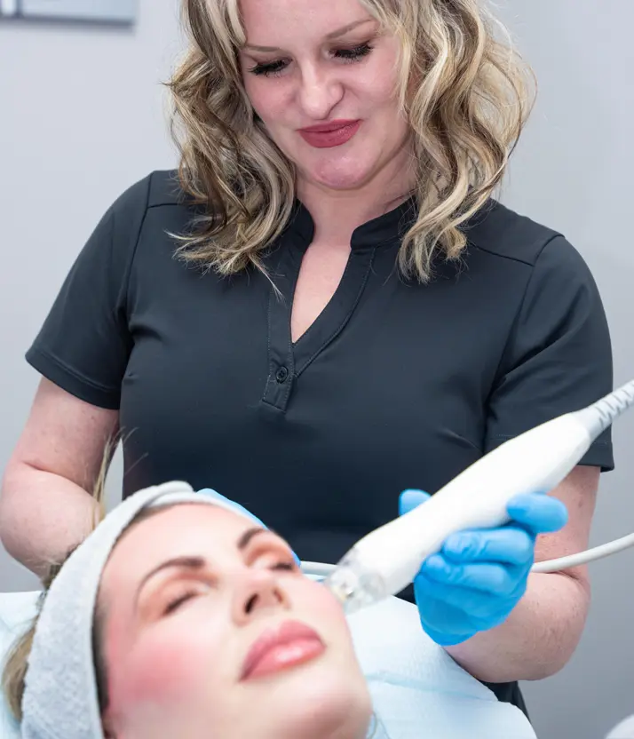 Doctor performing microneedling - RF Microneedling