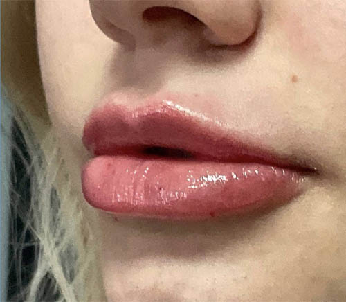 Lips