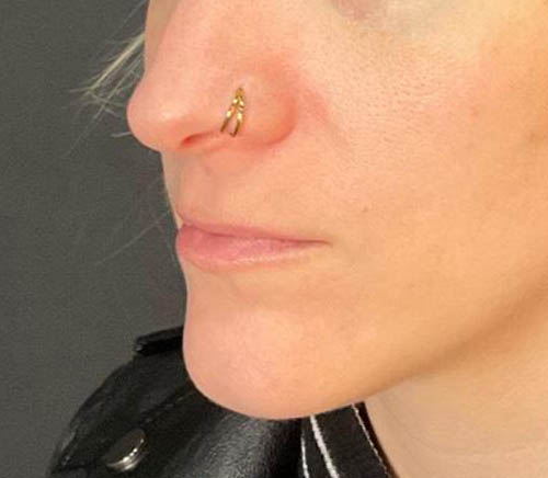 Lips