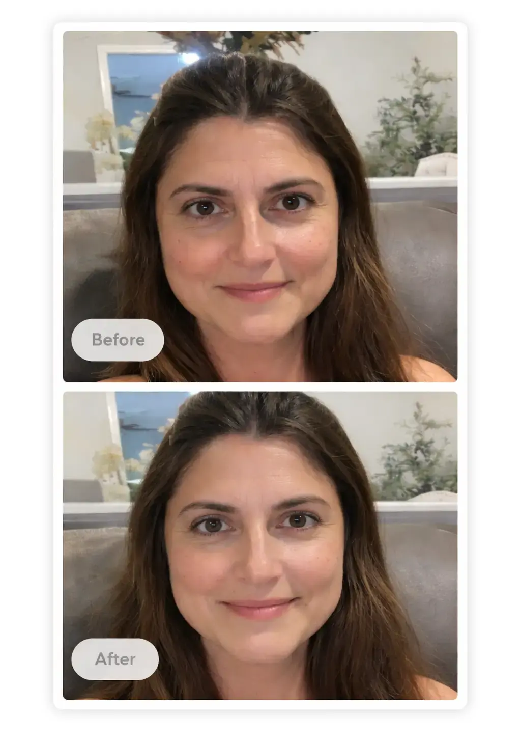 AI aesthetic preview before and after