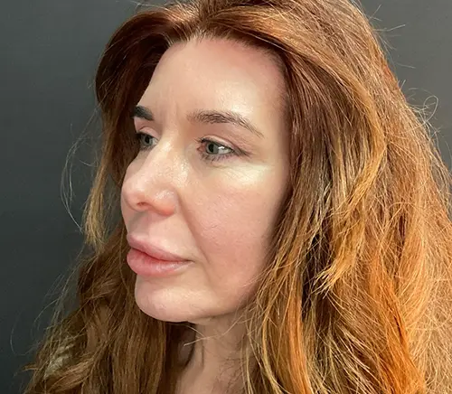 Lips