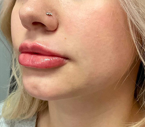 Jawline
